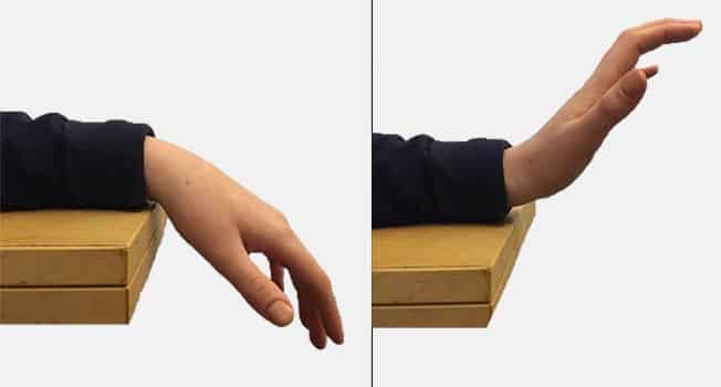 wrist physical therapy